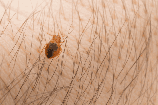 close-up of Bed bug crawling on the body of a person